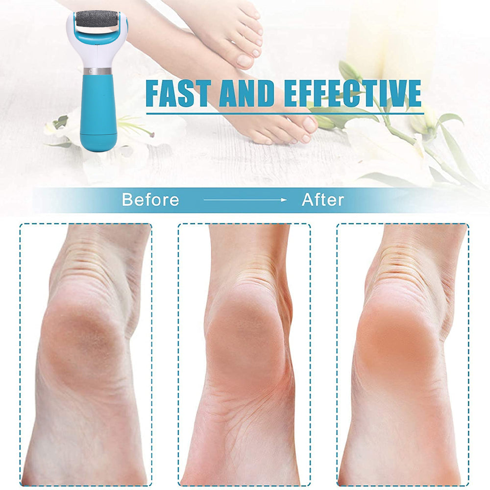 Electric Foot File Hard Skin Remover with 2 Rollers Rechargeable