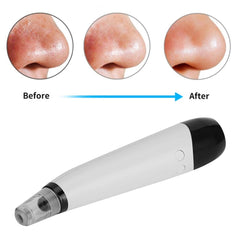 Electric Blackhead Removal Vacuum Suction Instrument Face Pore Cleaner with 6 Replaceable Heads