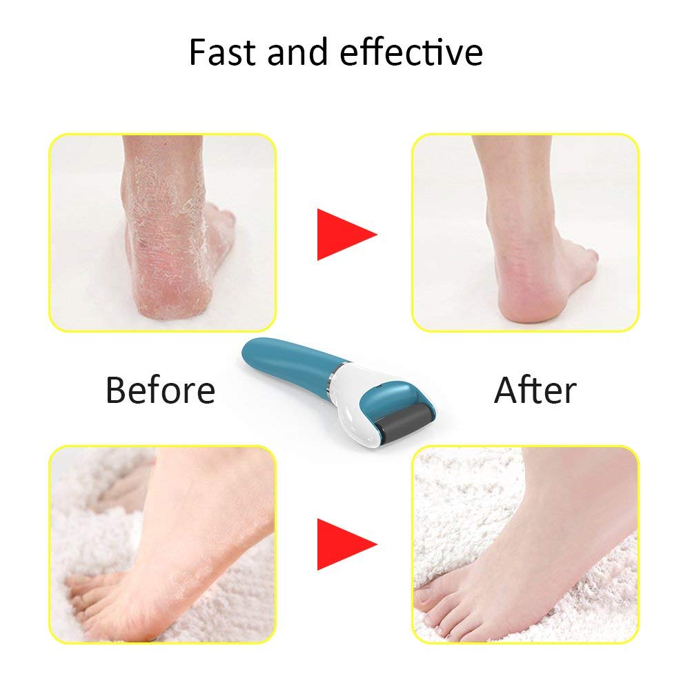 Electric Foot File Hard Skin Remover with 2 Rollers Rechargeable