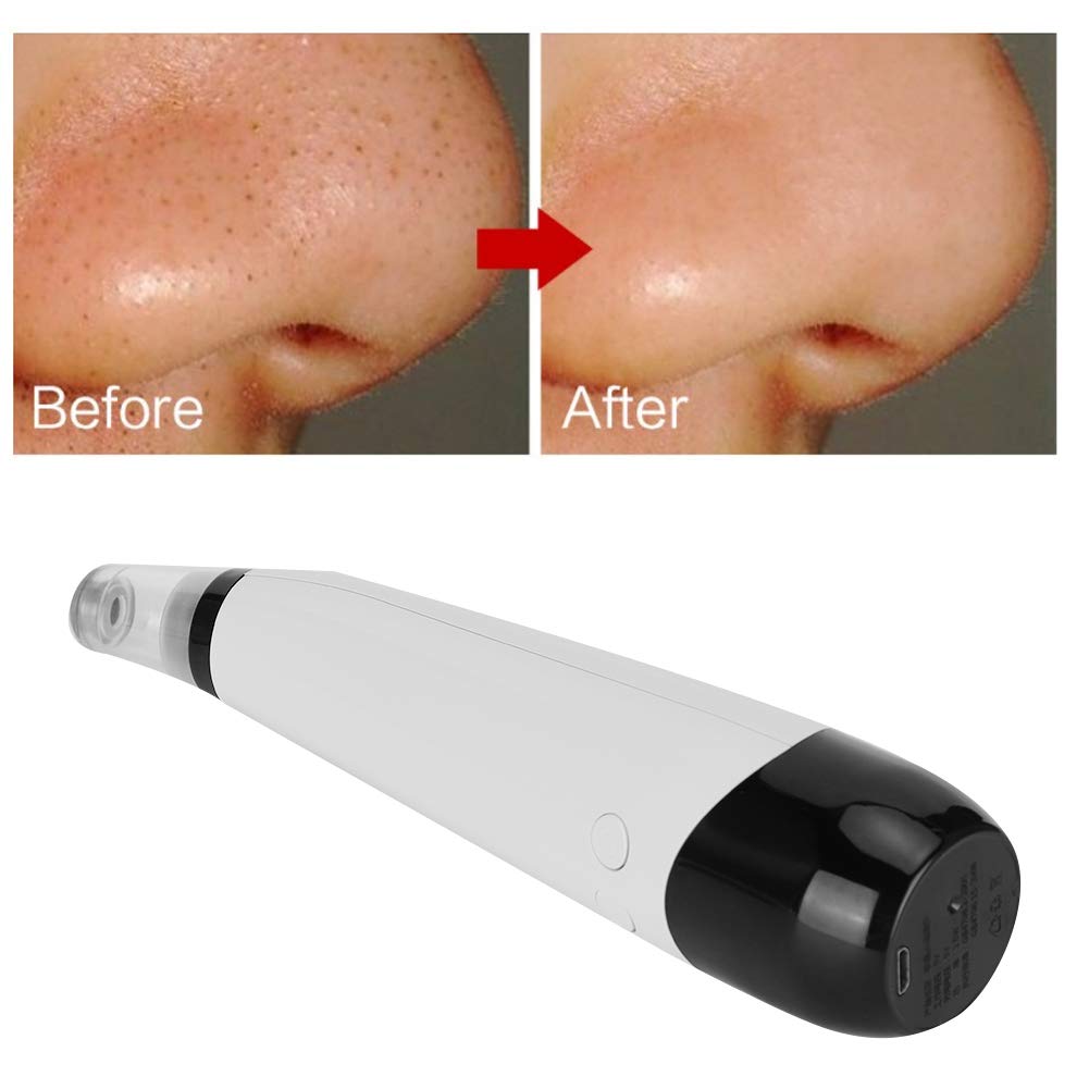 Electric Blackhead Removal Vacuum Suction Instrument Face Pore Cleaner with 6 Replaceable Heads